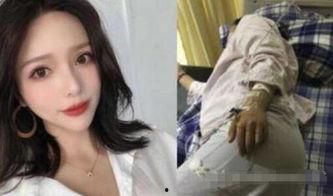 重庆孕妇爆料新闻事件,产检疑遭医生误诊，引发社会关注